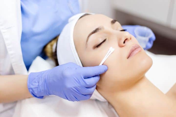 Skin Treatment by Chemical Peel