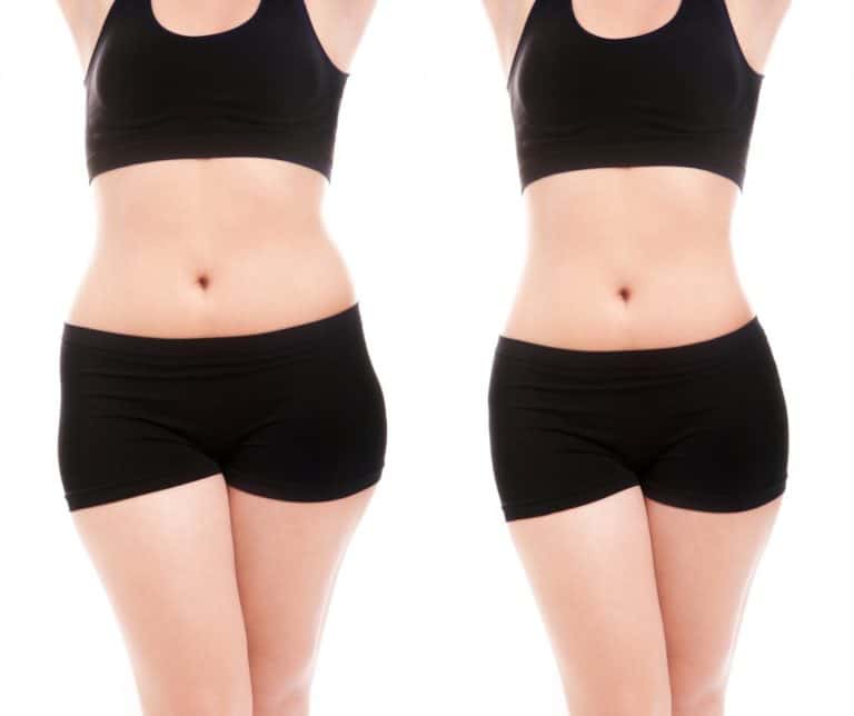 Fat Reduction Services