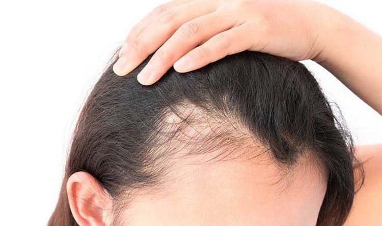 Hair Service Treatment Hair Treatment Services at Aesthetic Clinic Malaysia
