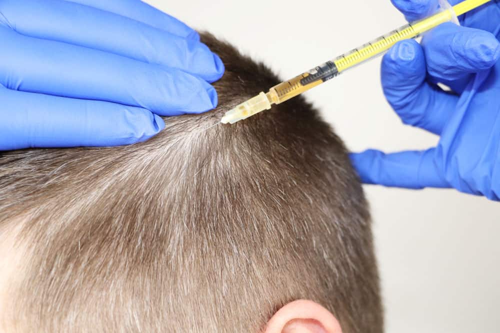 Mesotherapy 1 Mesotherapy 1