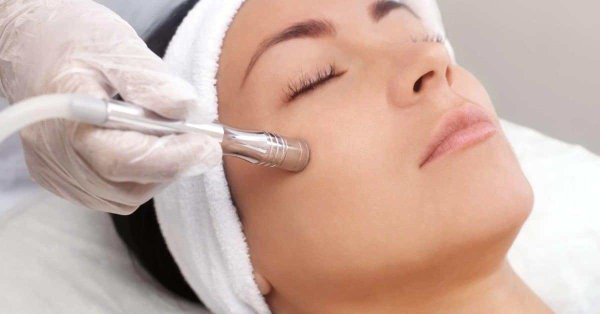 Microdermabrasion Microdermabrasion