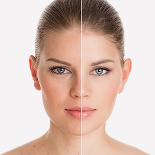 Anti Aging Face for Aesthetic Services Anti Aging at Aesthetic Clinic