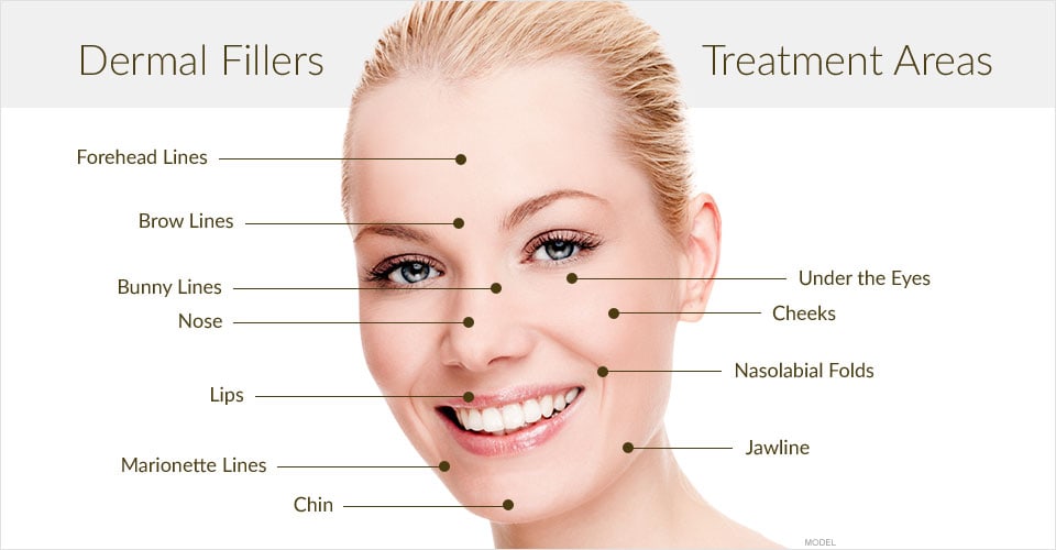 Dermal Fillers Treatment Areas
