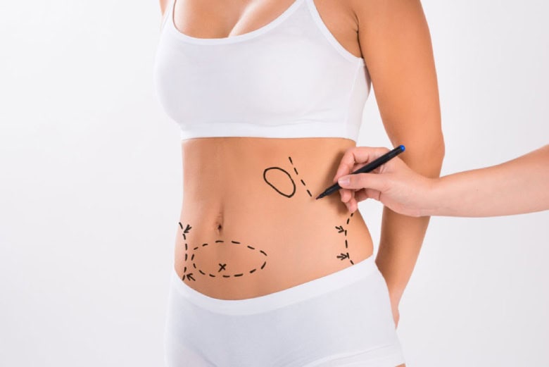 Fat Melting Reduction by Mesolipo Injection