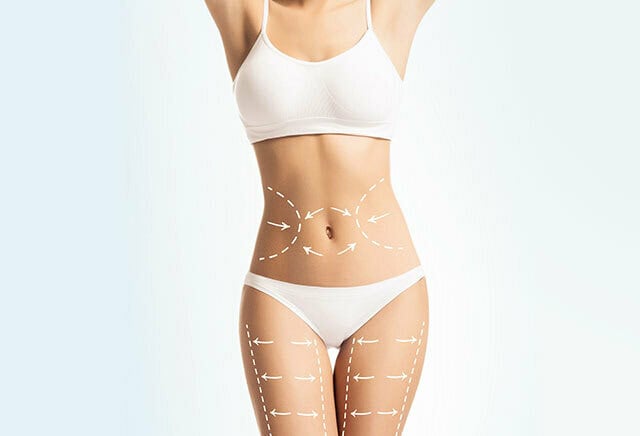 Body Fat Reduction of Female for Aesthetic Look Fat Body Reduction for Aesthetic Clinic Services Malaysia