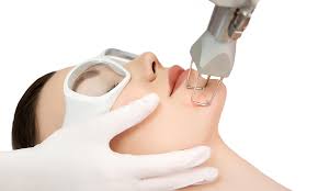 Fractional co2 Fractional Co2 Treatment