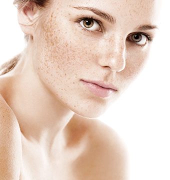 laser depigmentation Laser Depigmentation