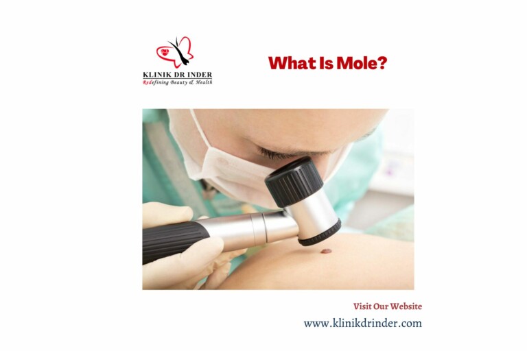 what is mole