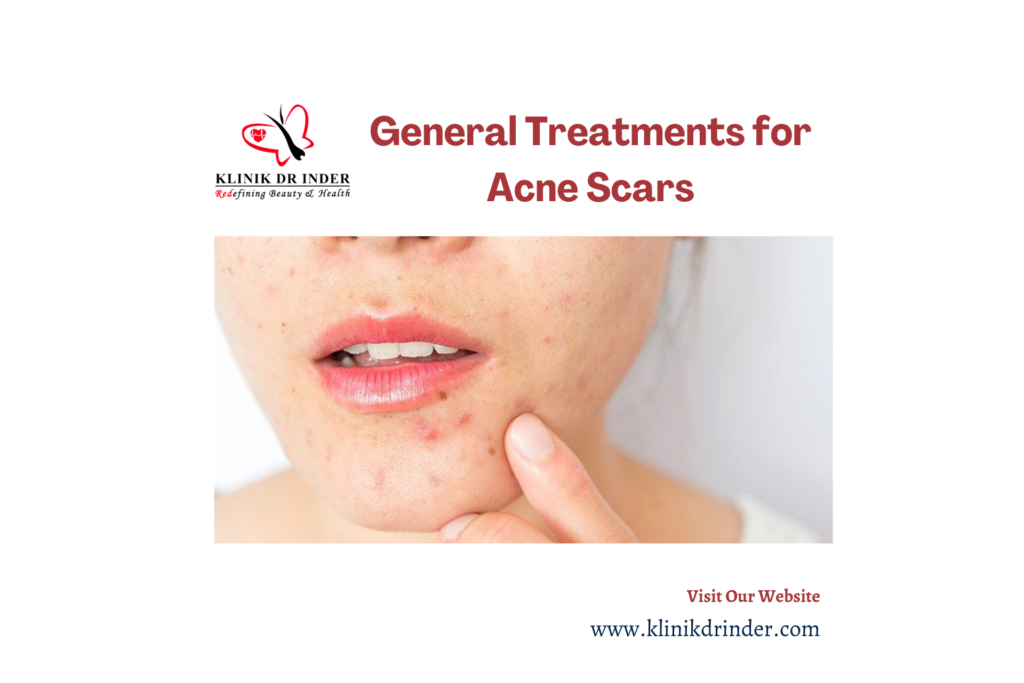 general treatments for acne scars