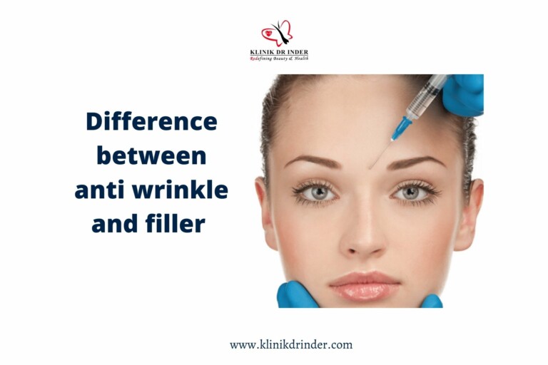 difference between anti wrinkle and filler 