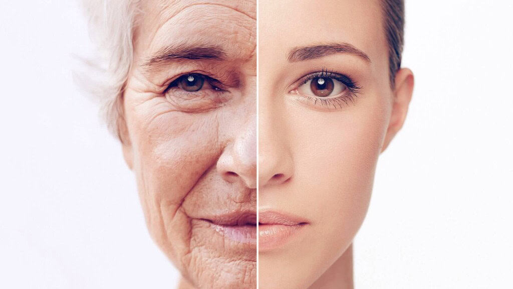 Anti Aging