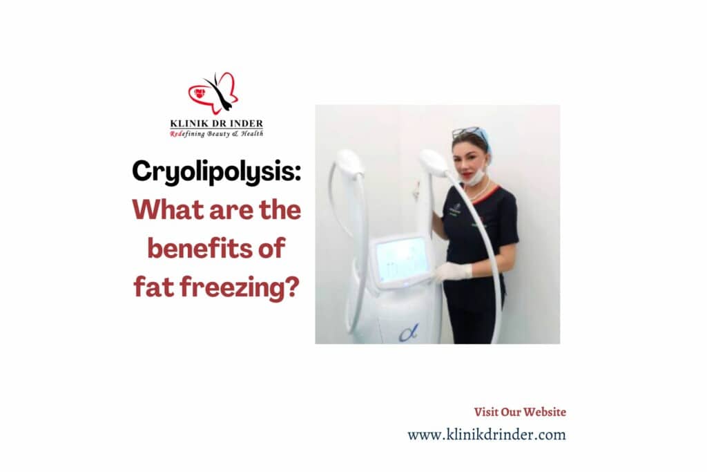 cryolipolysis what are the benefits of fat freezing