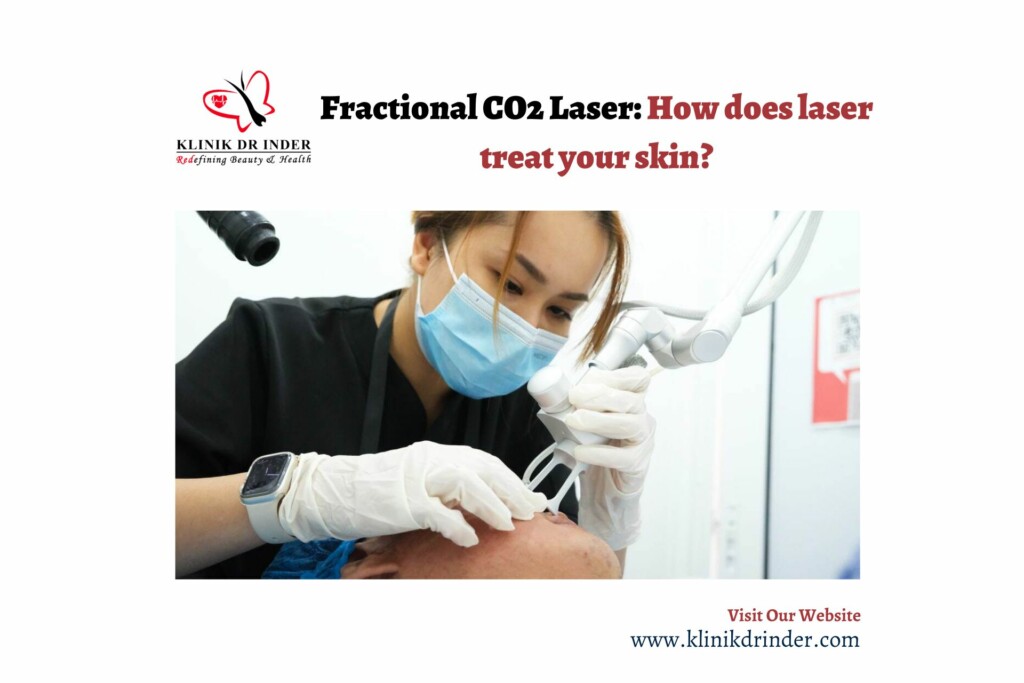 fraction co2 laser treatment banner