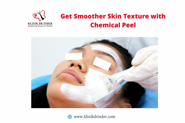 get smoother skin texture with chemical peel