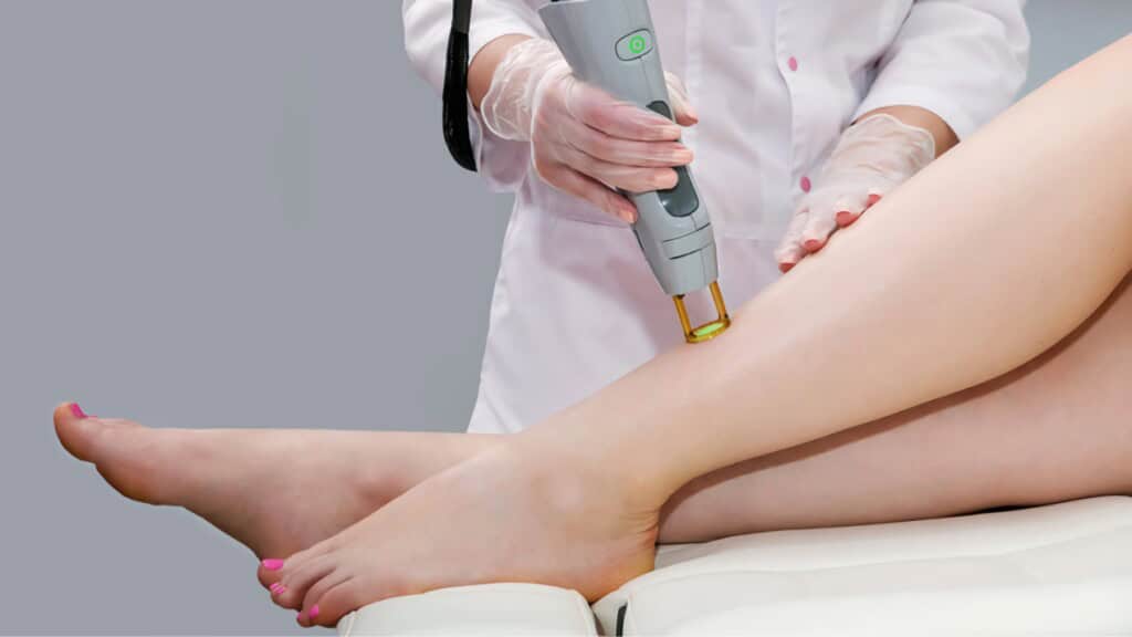 Laser Hair Removal