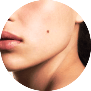 mole 1.png