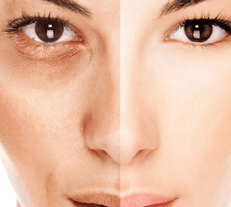 pigmentation cropped scaled 1 3 1.png