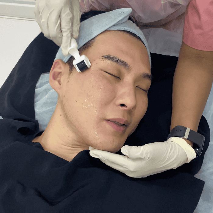 dermal roller.png