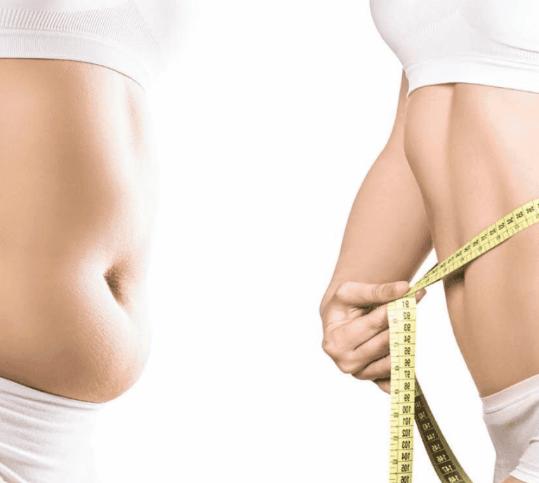 Fat Reduction