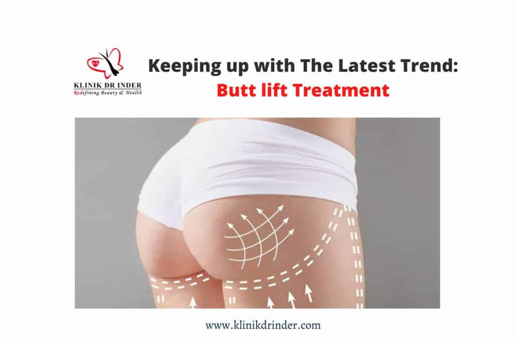 butt lift treatment