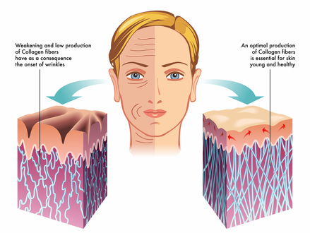 boosted collagen production