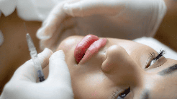 Juvéderm Dermal Fillers