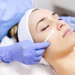 Skin Chemical Peel Skin Treatment by Chemical Peel