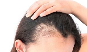 Hair Treatment Services at Aesthetic Clinic Malaysia