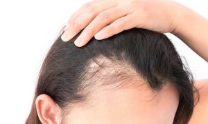 Hair Service Treatment Hair Treatment Services at Aesthetic Clinic Malaysia