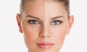 Anti Aging at Aesthetic Clinic