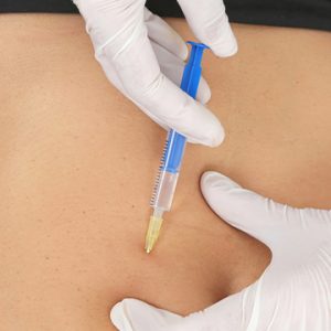 fat dissolving injection fat dissolving injection