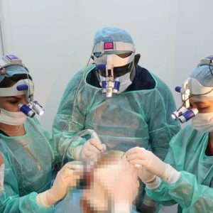 Fue Hair Transplant – Aesthetic Clinic Malaysia Fue Hair Transplant by Dr Inder