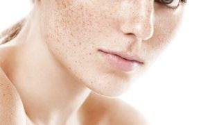 laser depigmentation Laser Depigmentation
