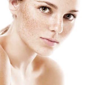 laser depigmentation Laser Depigmentation